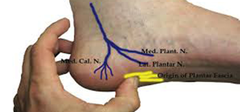 Glioma Surgery